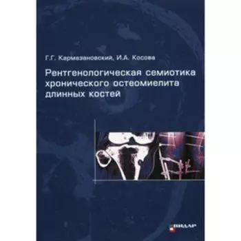 Рентгенологическая семиотика хронического остеомиелита длинных костей. Кармазановский Г.Г.
