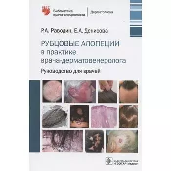 Рубцовые алопеции в практике врача-дерматовенеролога. Руководство для врачей. Раводин Р., Денисова Е.