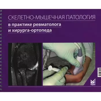 Скелетно-мышечная патология в практике ревматолога и хирурга-ортопеда. Каратеев А.Е., Макаров М.А., Макаров С.А.