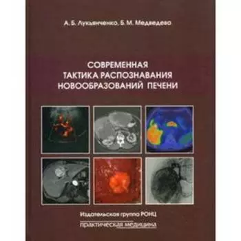Современная тактика распознавания новообразований печени. Лукьянченко А.Б., Медведева Б.М.