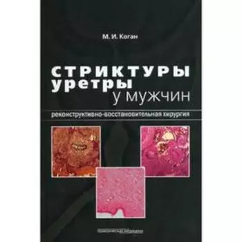 Стриктуры уретры у мужчин. Реконструктивно-восстановительная хирургия. Коган М.И.