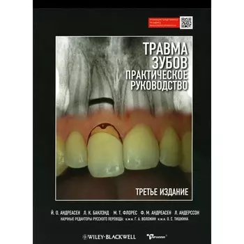 Травма зубов. Практическое руководство. 3-е издание. Андреасен Й.О., Баклэнд Л.К., Флорес М.Т., Андреасен Ф.М., Андерссон Л.