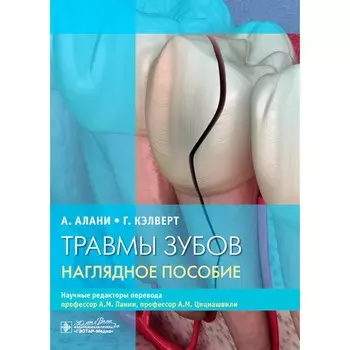 Травмы зубов. Наглядное пособие. Алани А., Кэлверт Г.