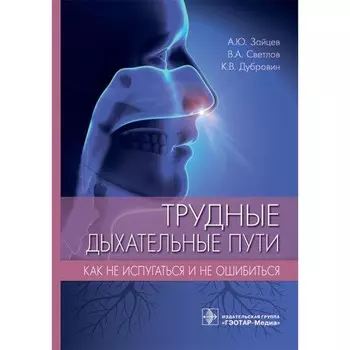 Трудные дыхательные пути. Как не испугаться и не ошибиться. Зайцев А.Ю., Светлов В.А., Дубровин К.В.