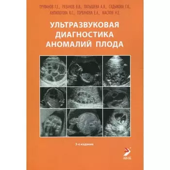 Ультразвуковая диагностика аномалий плода. 3-е издание. Труфанов Г.Е., Рязанов В.В., Латышева А.Я.