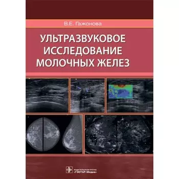 Ультразвуковое исследование молочных желез. Гажонова В.