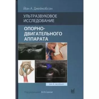 Ультразвуковое исследование опорно-двигательного аппарата. Джейкобсон Й.А.