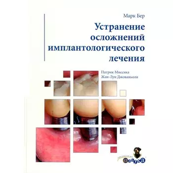 Устранение осложнений имплантологического лечения. Джованьоли Ж.-Л., Бер М., Миссика П.