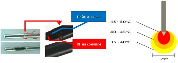 "Иннофилл в косметологии: Экспертный подход к лечению рубцов и омоложению"