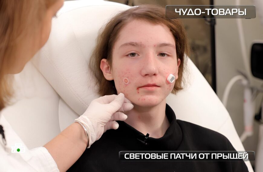 Проверка патчей с фонариками против прыщей