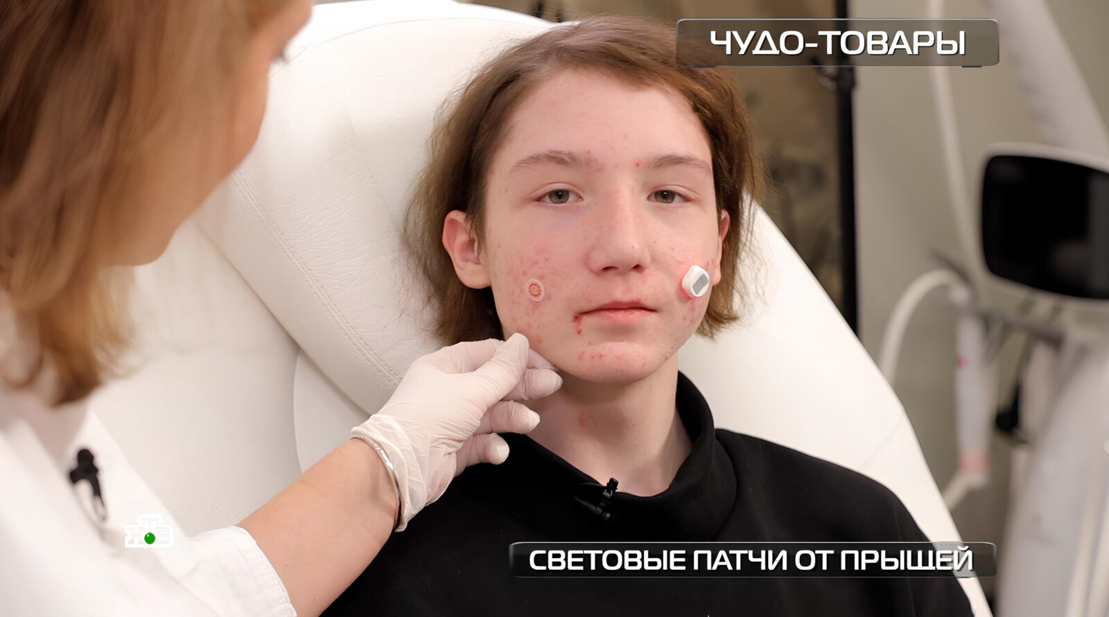 proverka patchej s fonarikami protiv pryshhej ad6bcae