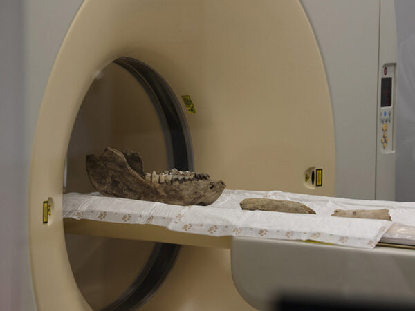 Рентген кости челюсти на сканере томографа в лаборатории.