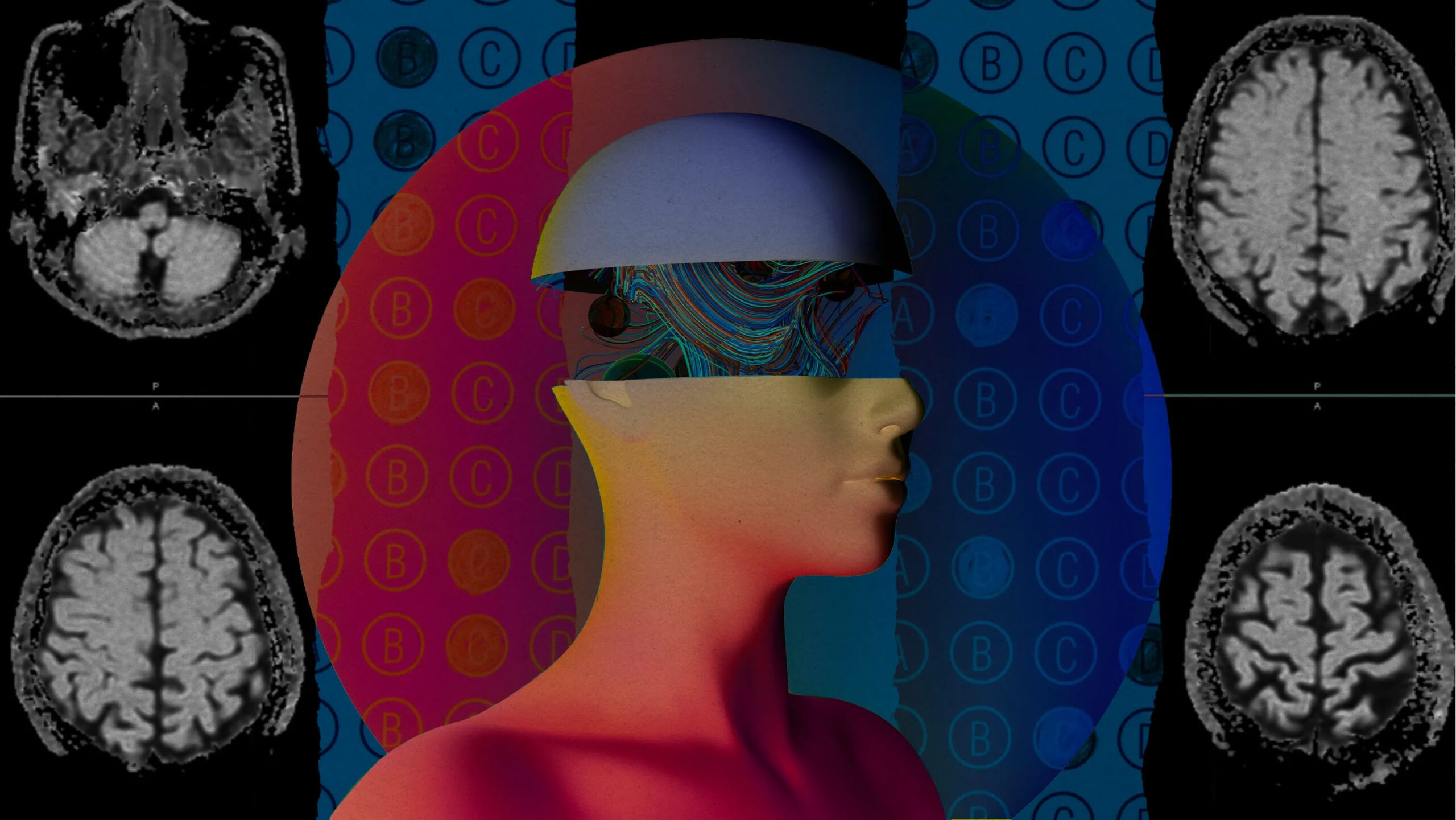 Абстрактное изображение с раскрытой головой и изображения МРТ мозга.