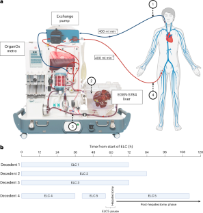 Машина для перфузии органов и схема кровообращения с печенью человека.