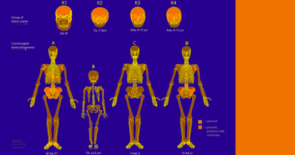 Схема скелетов людей разного возраста с подписями на фиолетовом фоне.