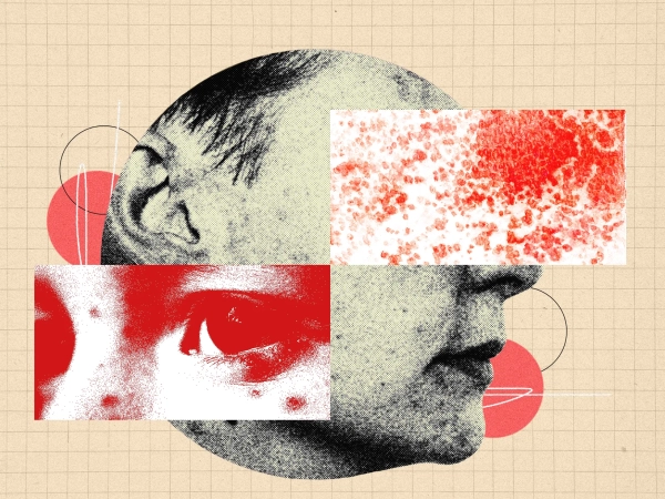 Абстрактный портрет с фрагментами лица и текстурами на клетчатом фоне.