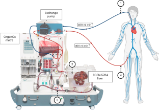 Экстракорпоральное перекрестное кровообращение с использованием генетически модифицированной свиной печени на модели умершего человека. 4 Схема системы OrganOx для поддержки работы печени и сердца человека.