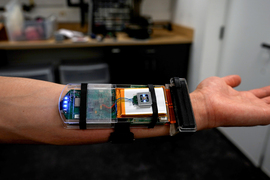 Устройство на запястье для мониторинга здоровья. Технология будущего для медицины.