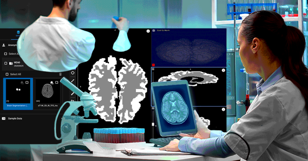Исследователи анализируют снимки мозга на мониторах в научной лаборатории.