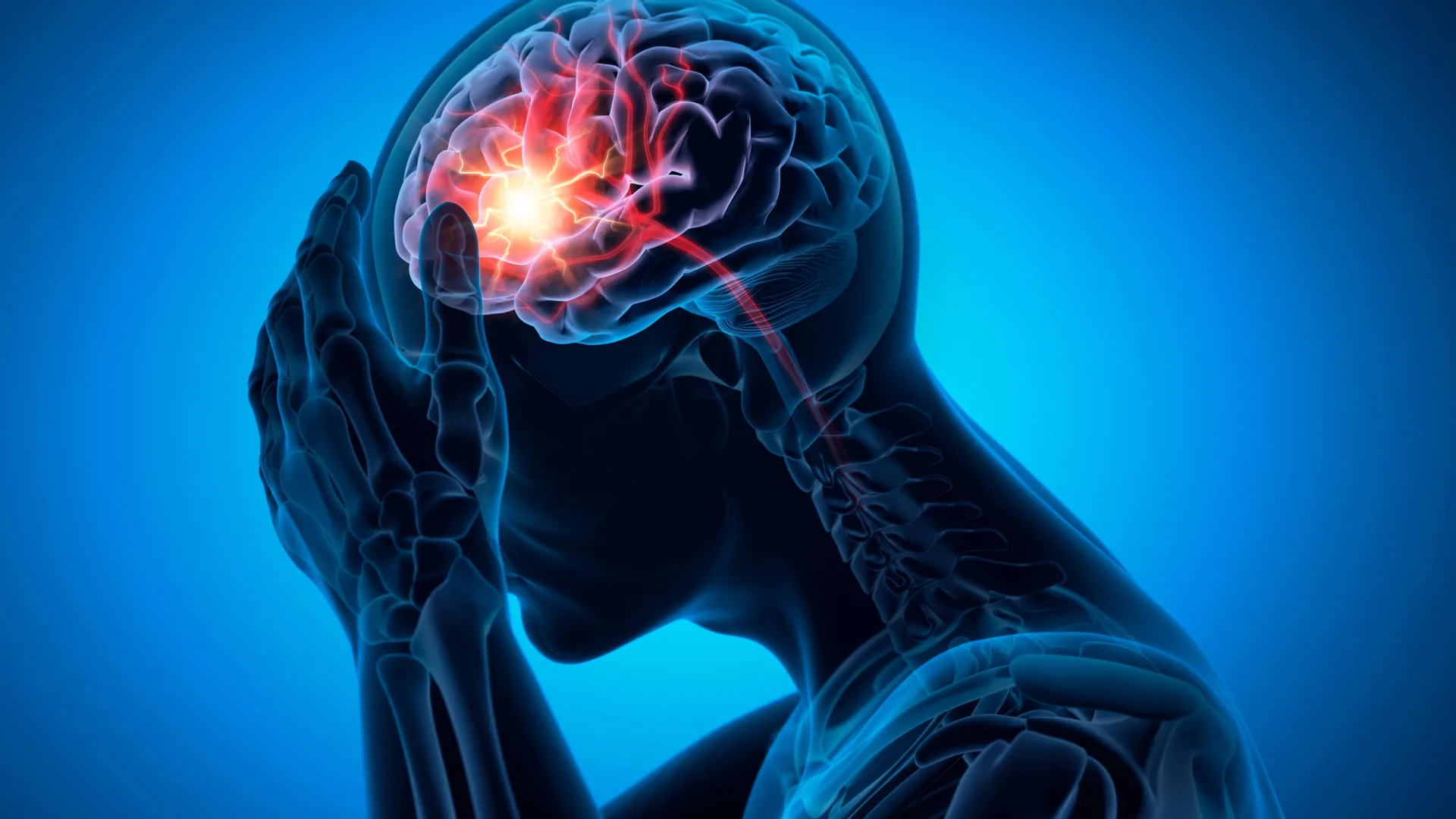 3D-иллюстрация человека с болью в голове, светящийся участок мозга, нейронные сигналы.