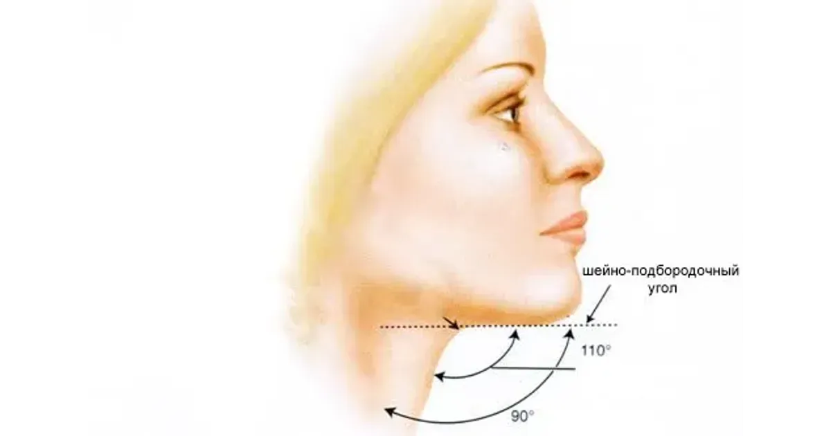 Линия челюсти. Угол молодости на лице. Угол молодости на лице упражнения. Эстетическая плоскость лица. Как называются уголки подбородка.