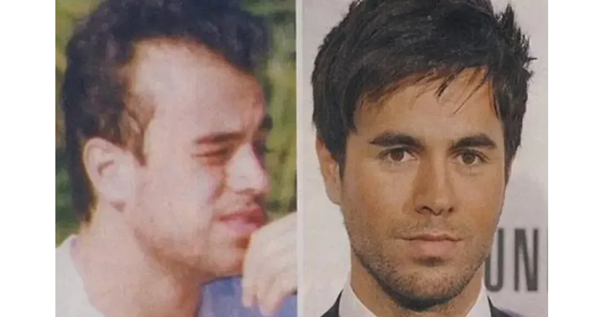 Волосы форум мужчины. Энрике Иглесиас в молодости и сейчас. Enrique Iglesias в молодости. Энрике Иглесиас полысел. Энрике Иглесиас в 14 лет.
