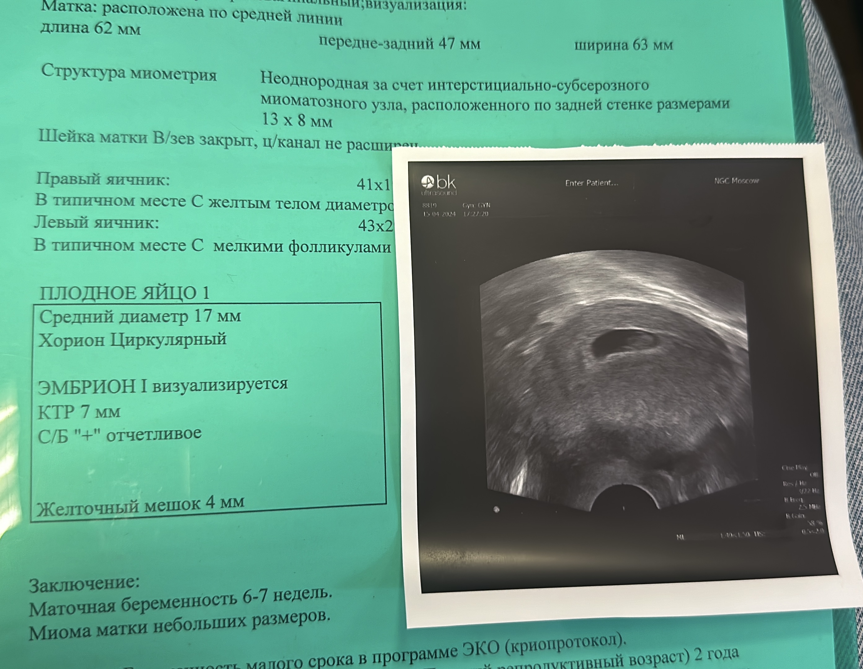 Изображение