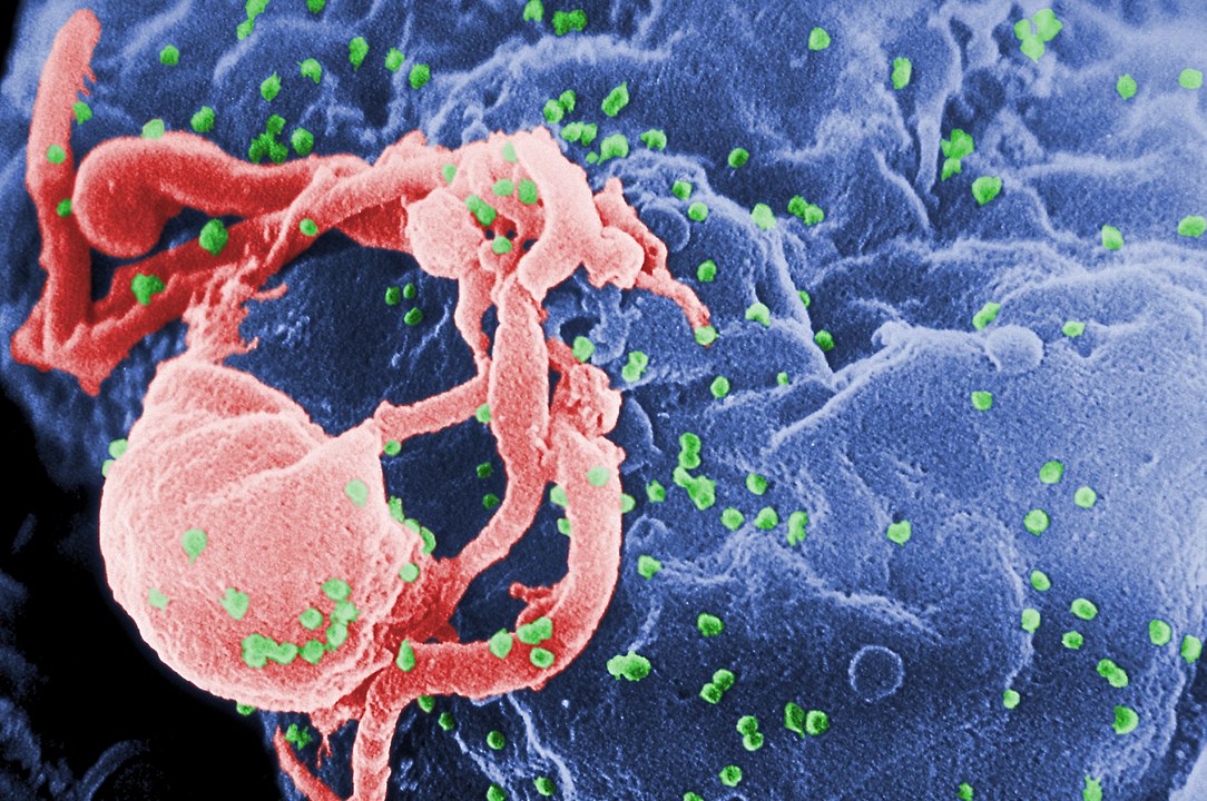 Ученые разработали препарат для лечения рака, и выясняли, что он может уничтожить и ВИЧ          