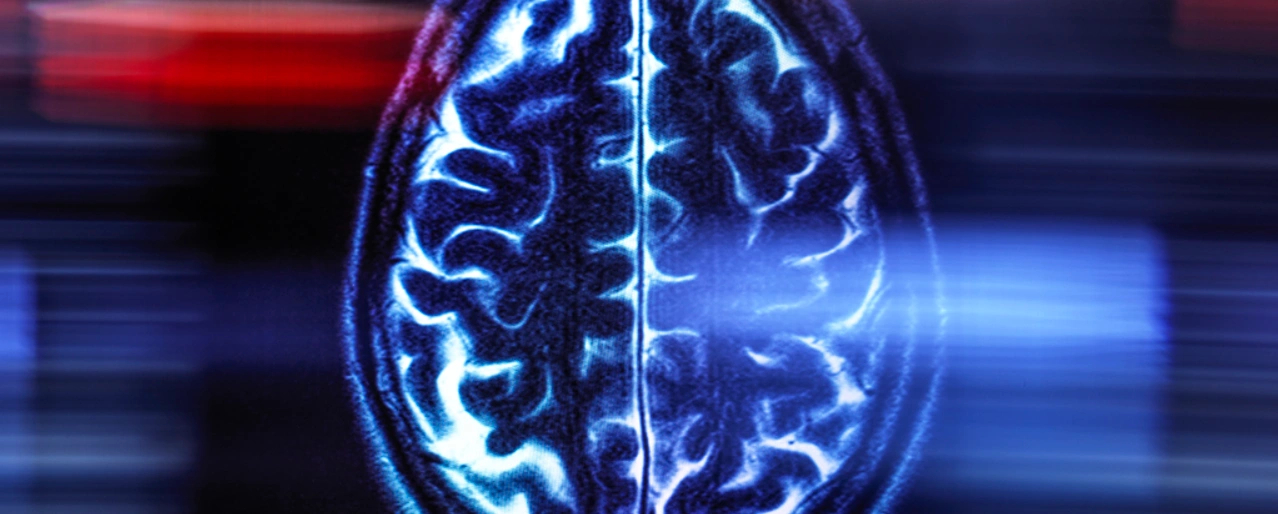 Один снимок мозга может рассказать, сколько вашему организму на самом деле лет