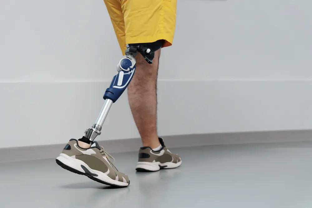 Russian Scientists Showcase Smart Insoles and 3D-Printed Prosthetics