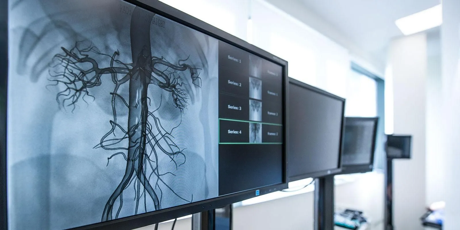 Moscow’s AI System for Detecting “Broken Hearts” Helps Save Tens of Thousands of Lives