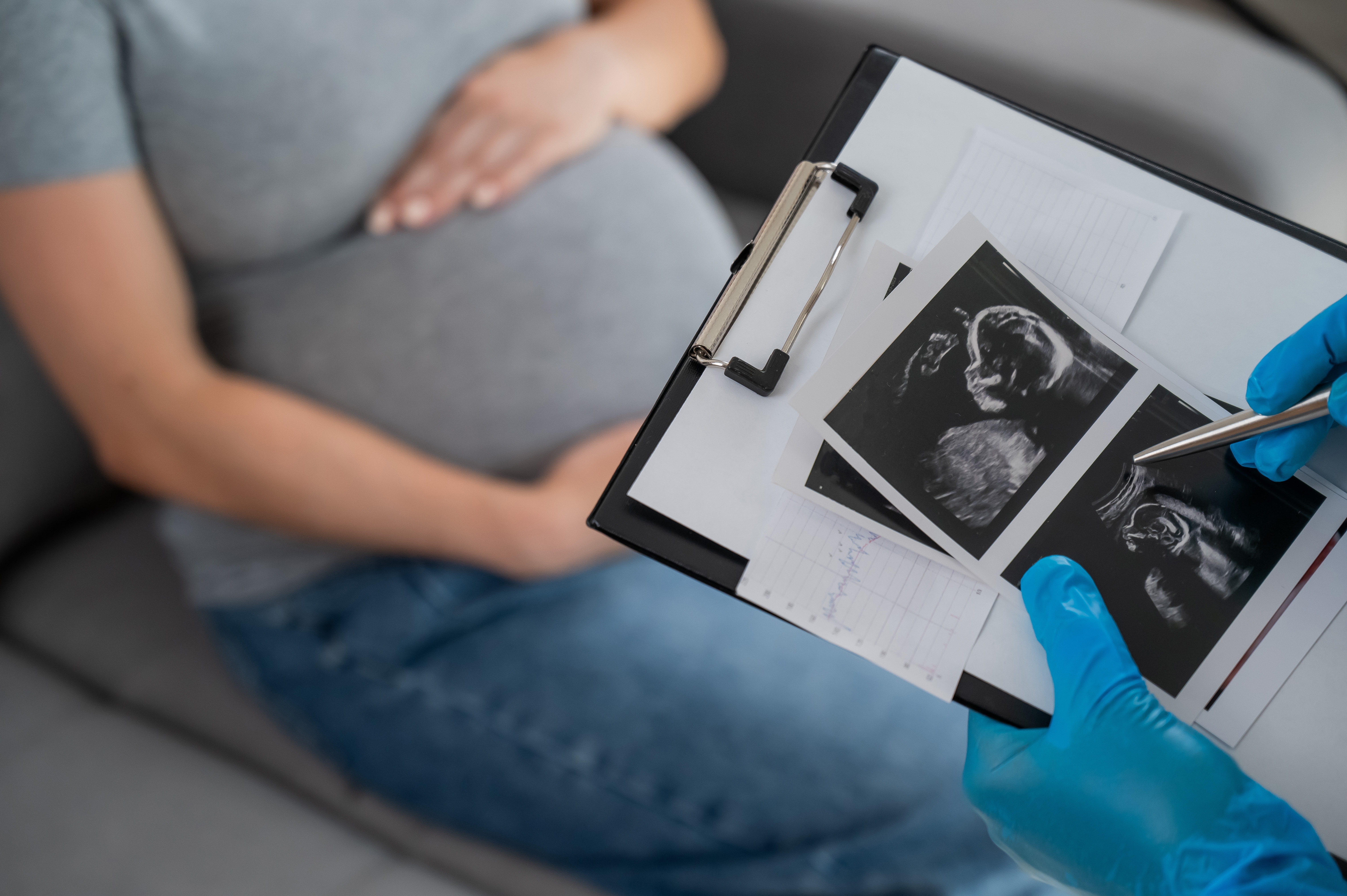 Russia Launches AI-Based Remote Monitoring Program for Pregnant Women