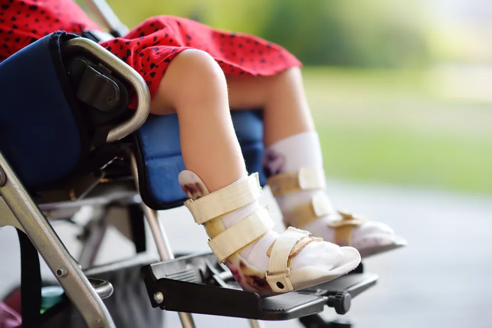 Russian Scientists Develop Smart Rehabilitation Footwear for Children with Cerebral Palsy