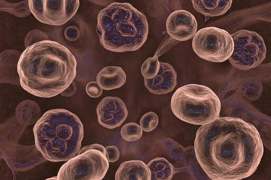 Perm Scientists Develop Method to Predict How Aggressive Cancer Tumors Are