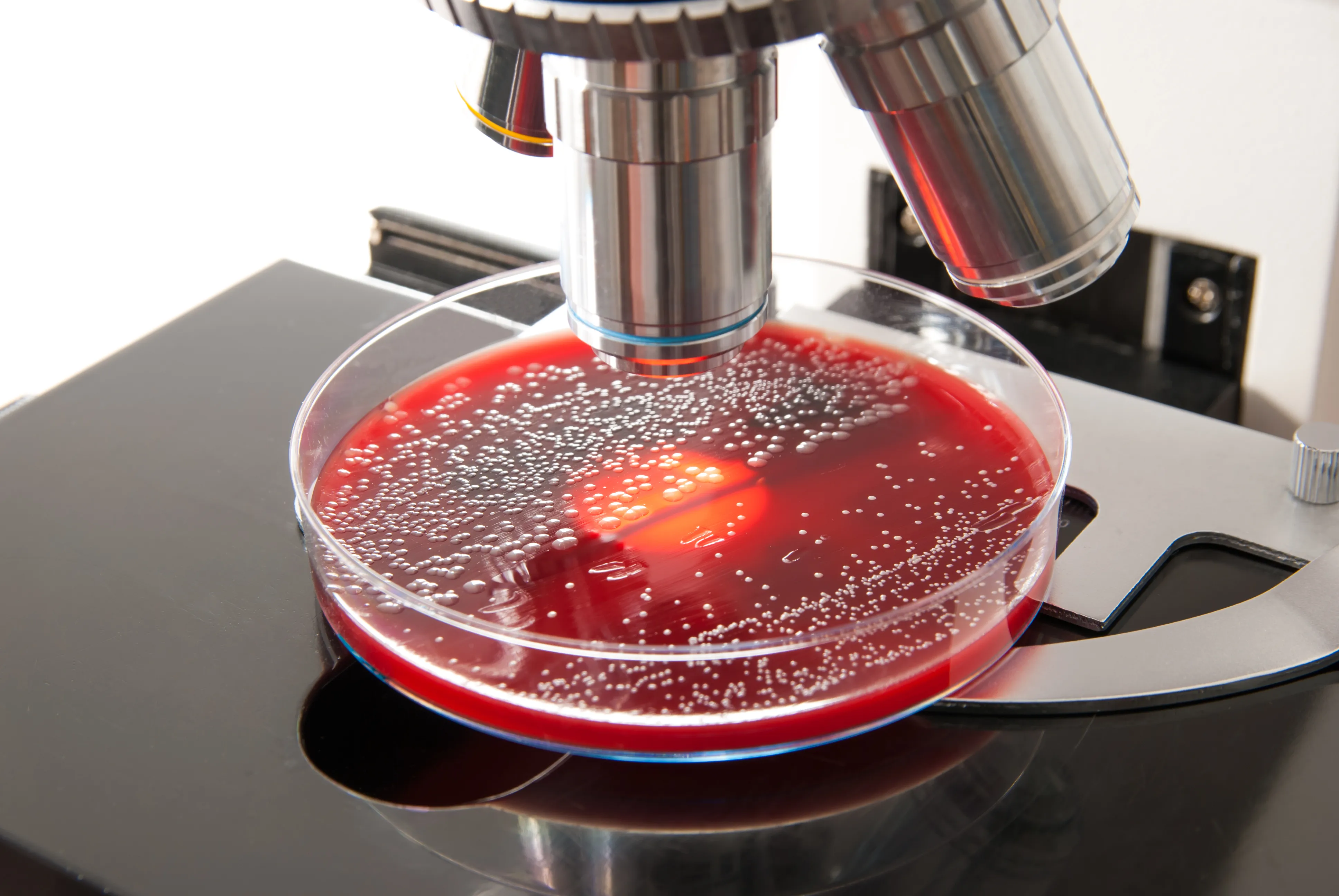 Photo - AI in the Petri Dish: Russia Launches Breakthrough Microbiological Analyzer