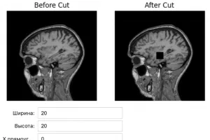 Russian Researchers Develop Platform for Generating Synthetic MRI Images