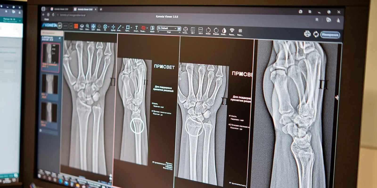 Russian Trauma Surgeons Gain ‘Smart’ Assistants