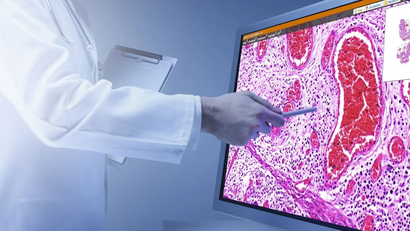 Russia Develops Digital Scanner for Histology and Cytology