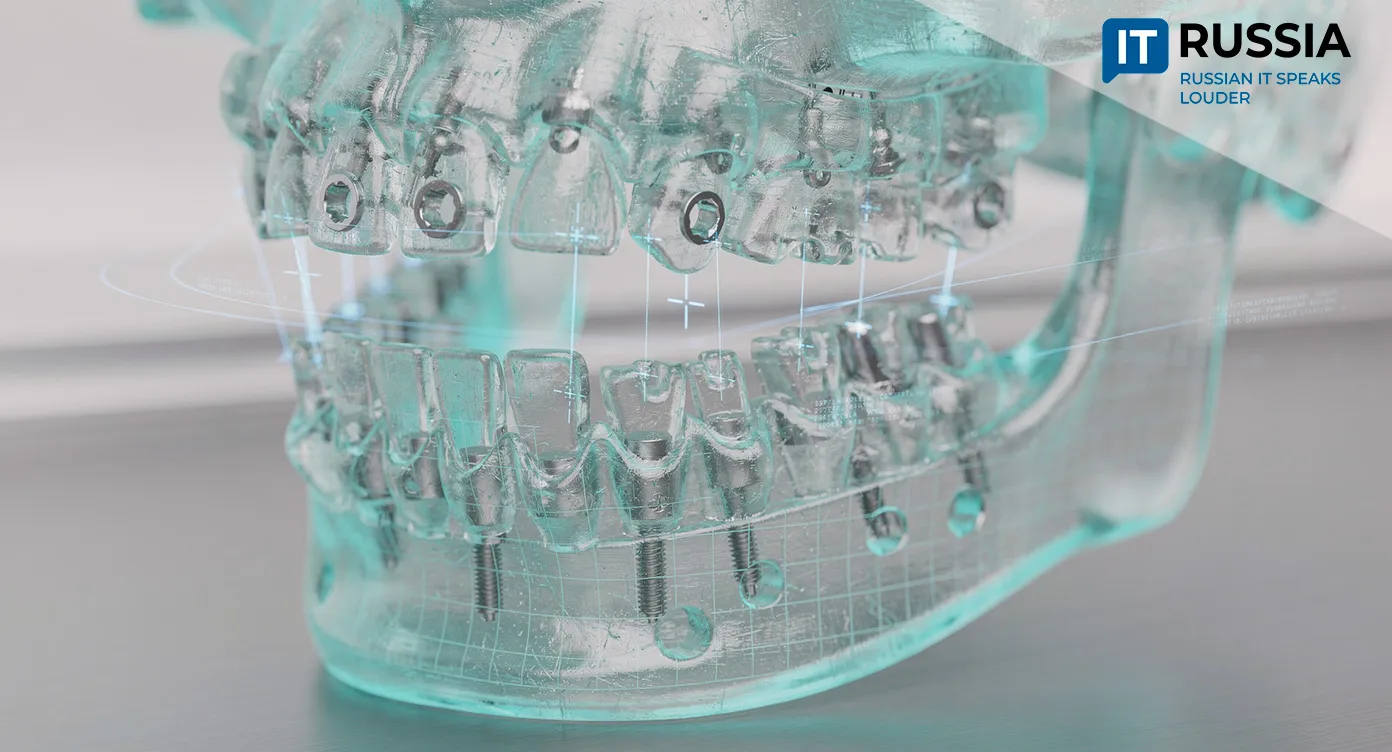 Семь раз отмерь: в России стоматологи освоили выпуск 3D-навигаторов для точной установки имплантатов