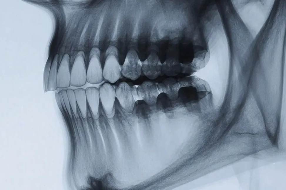 Neural Network in Russia Is to Learn to “Read” Jaws From Imaging Scans