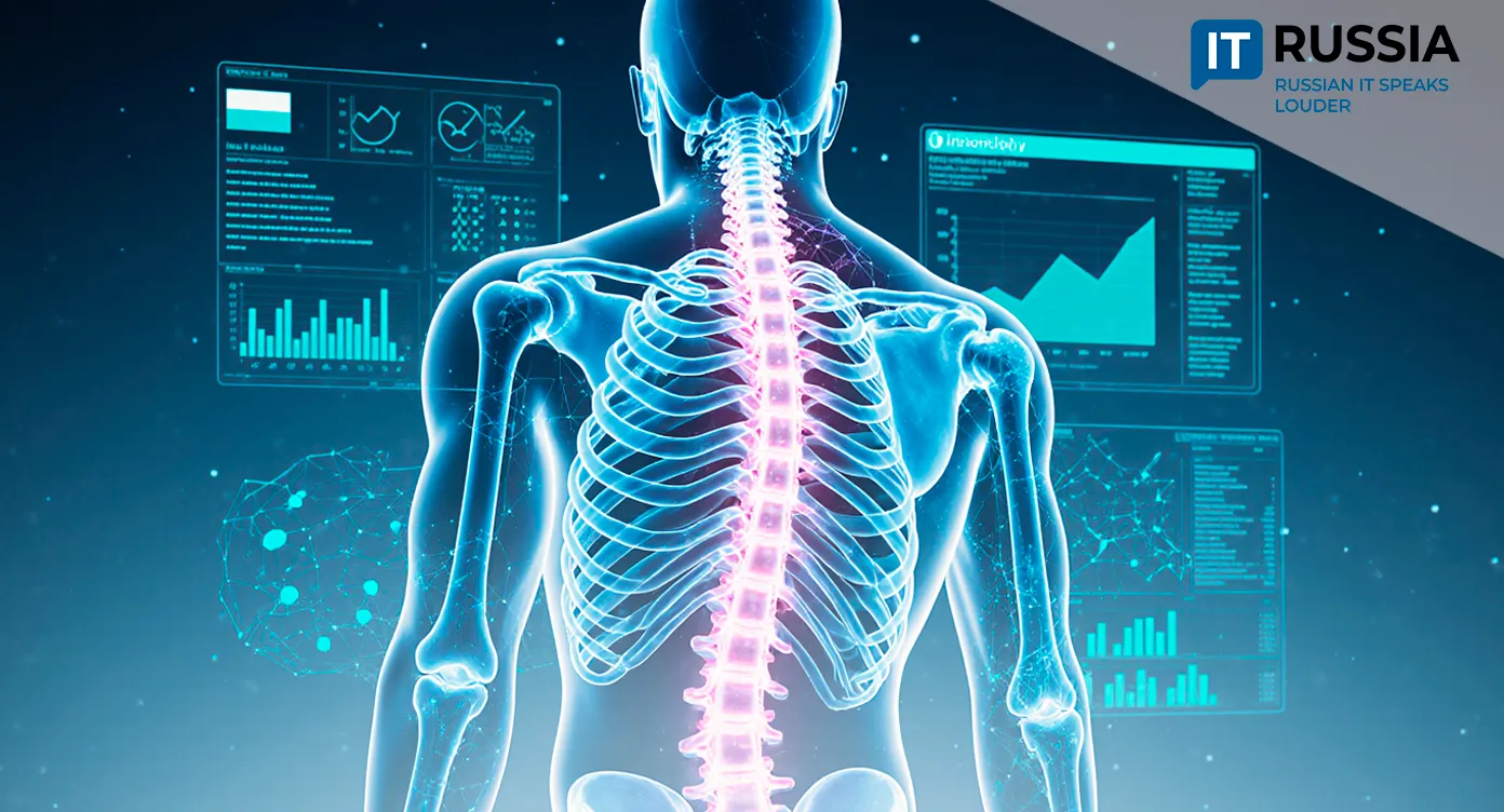 Russian AI Helps Detect the 'Silent Fracture' Disease