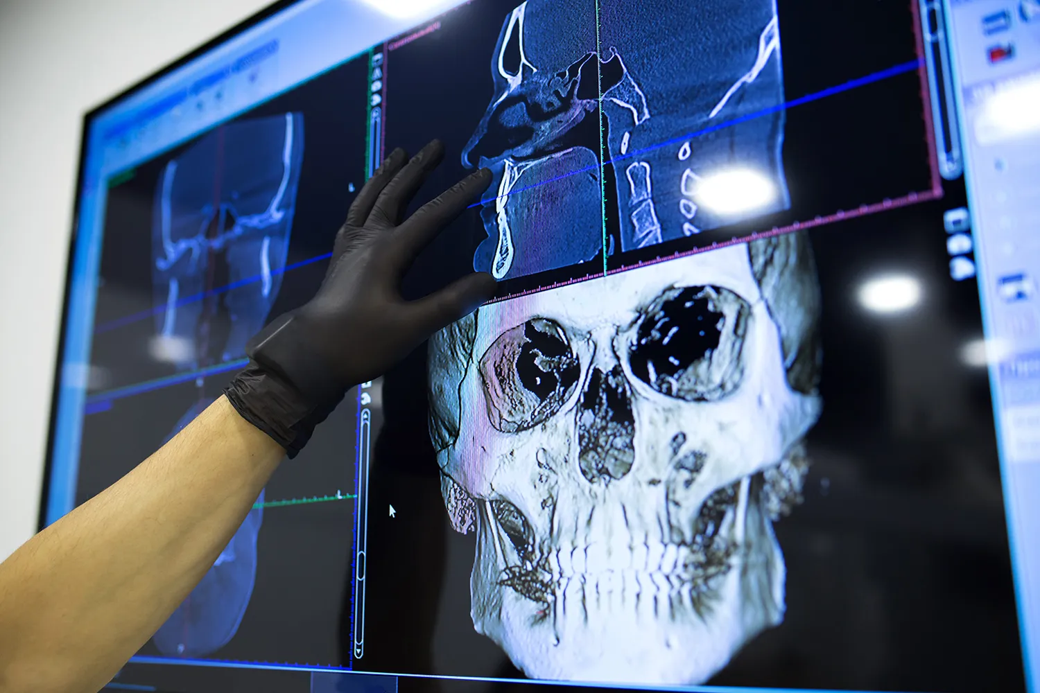 Photo - В Новосибирске нейросеть проводит диагностику и проектирует импланты