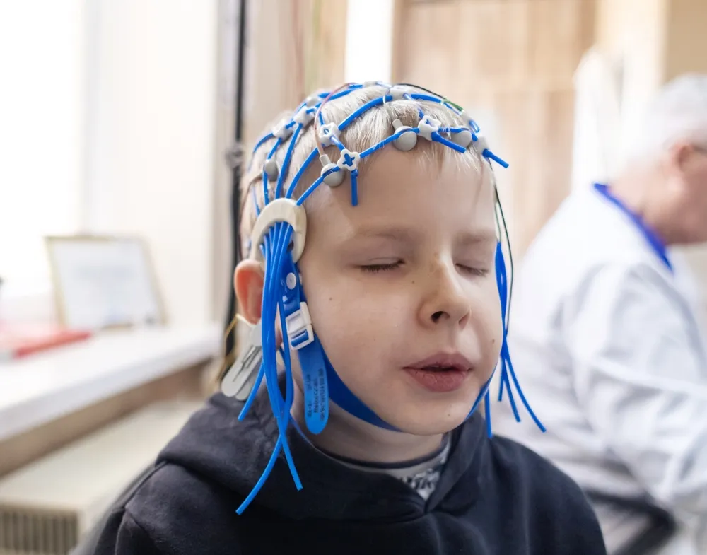 Russian Scientists Teach an AI System to Detect Epilepsy During Sleep