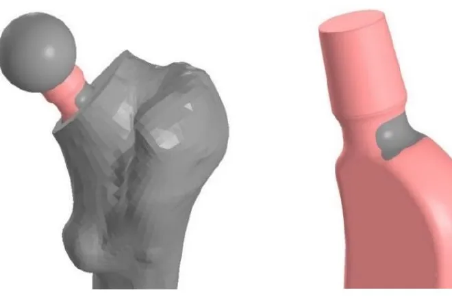 Russian Scientists Build a Digital Model for Longer-Lasting Joint Implants
