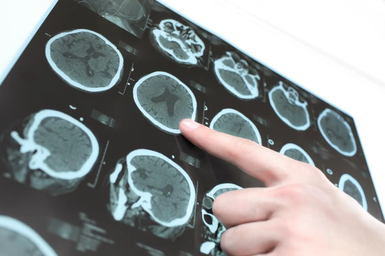 In Russia, Neural Network Helps Diagnose Neurological Disorders in Children