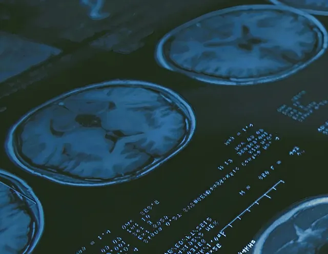 AI Scans 40,000 Medical Images in Russia’s Tver Region in One Year