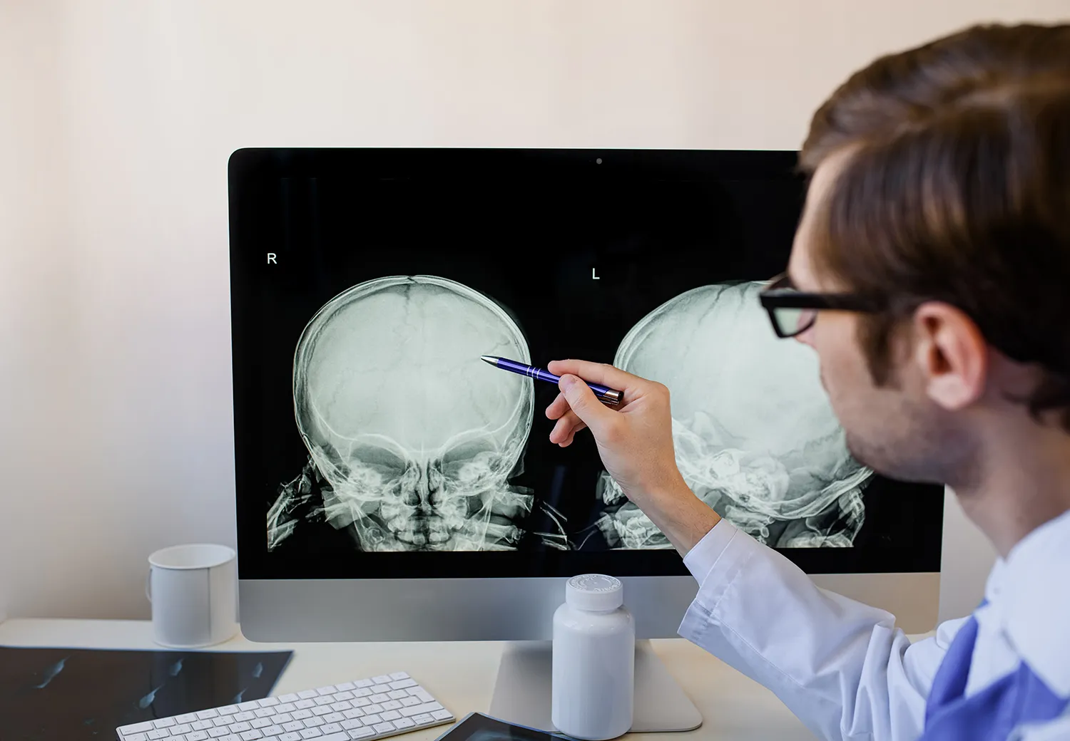Photo - In Novosibirsk, Neural Networks Assist in Diagnostics and Implant Design