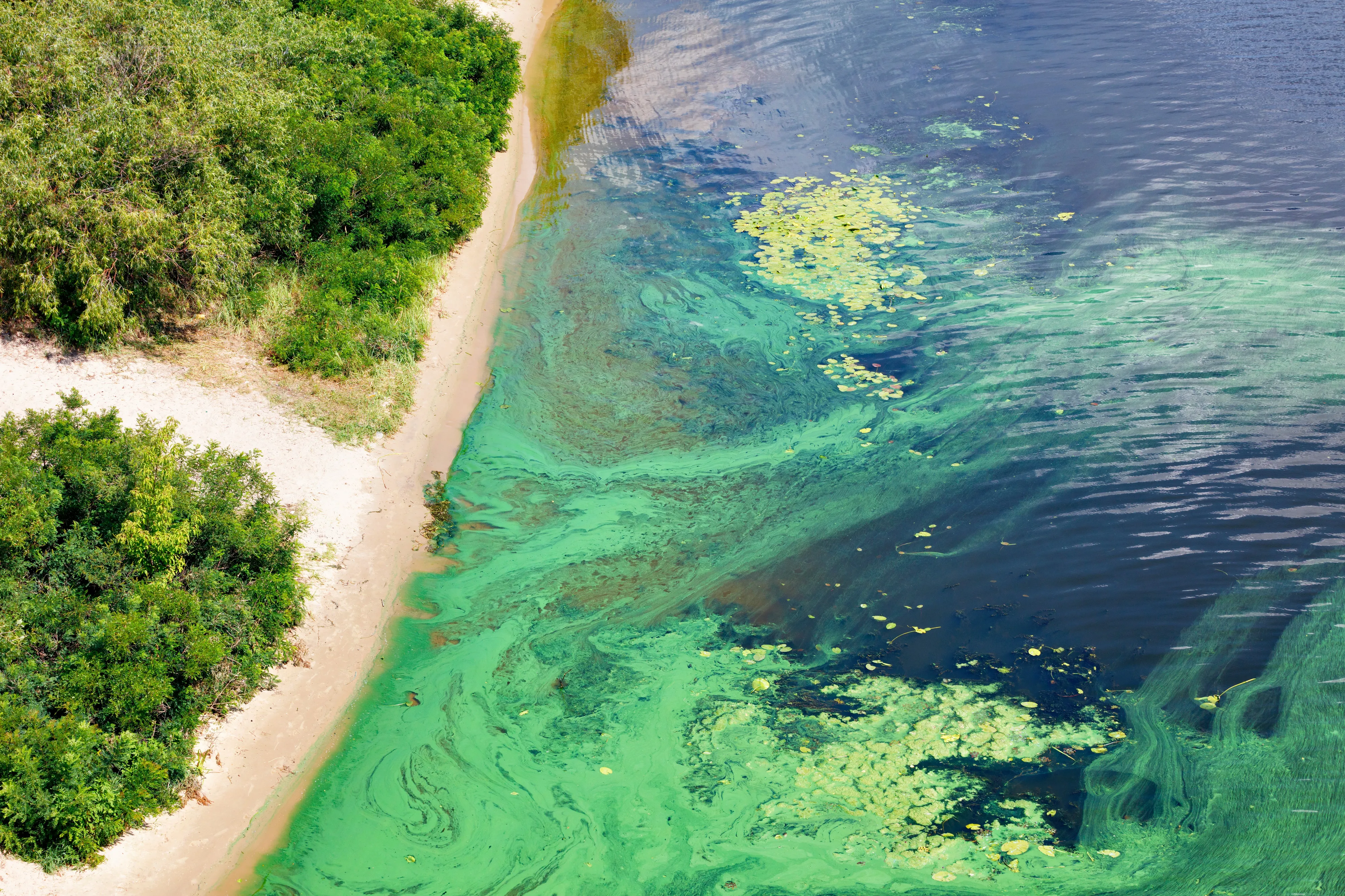 Russia Is Building a High-Tech Shield Against Toxic Algae Blooms