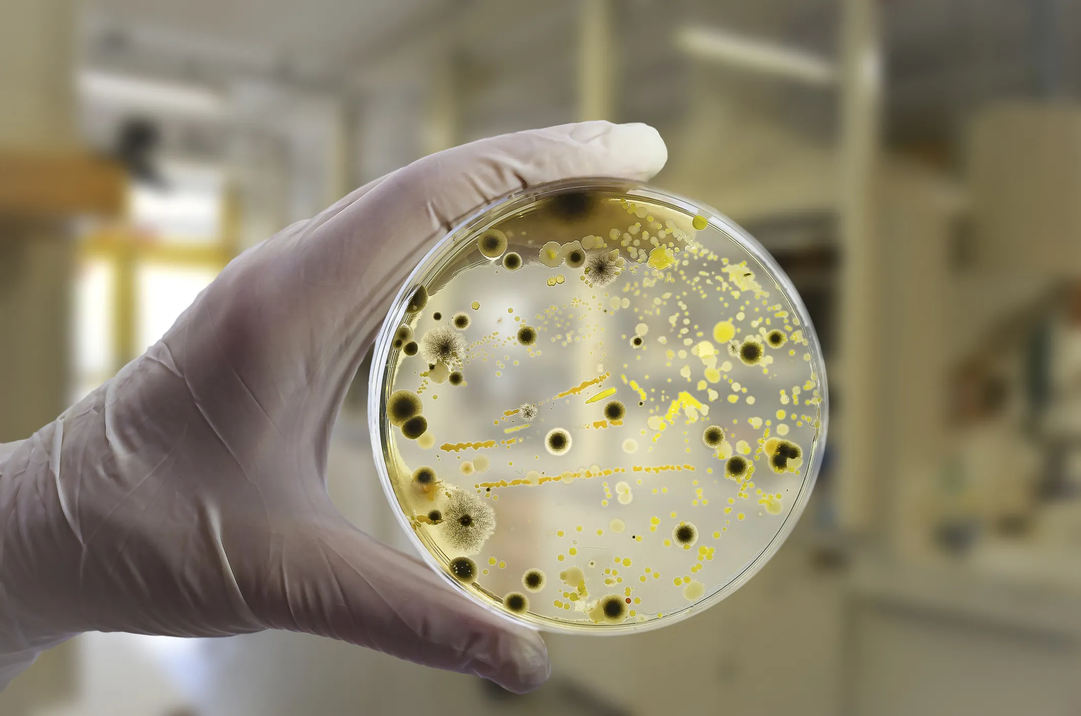 Russian Scientists Unveil AI‑Powered “Smart” Microorganism Counter
