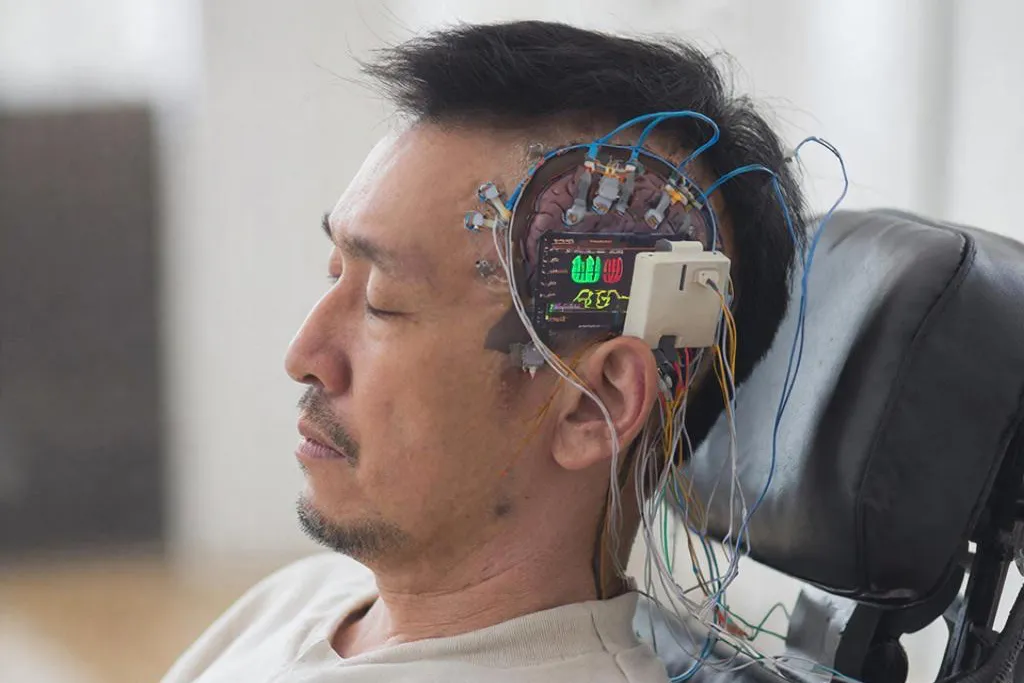 In Russia, Parkinson’s Disease May Be Defeated by “Smart” Brain Stimulation